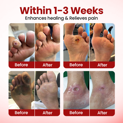 VitaGluco Diabetic Care Cream