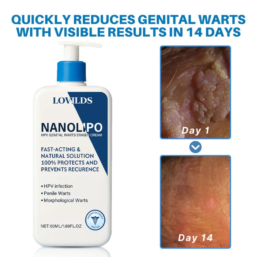 DeepClear Wart Repair Cream