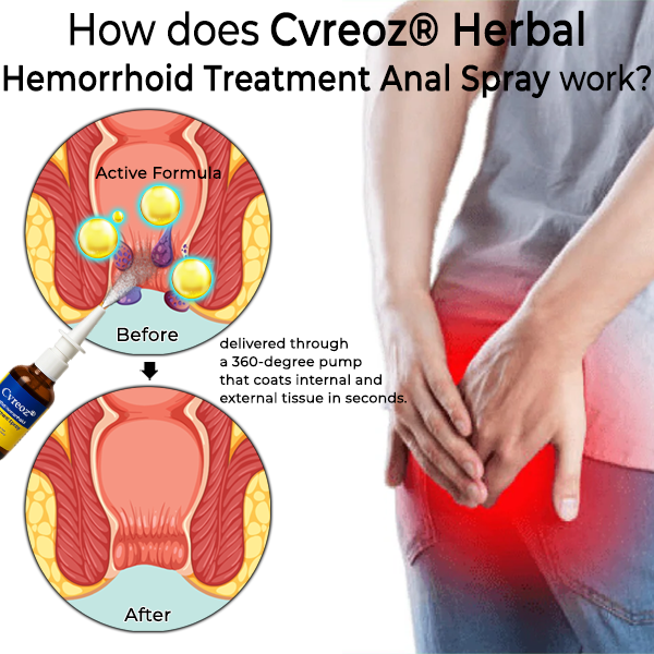 Cvreoz® Herbal Hemorrhoid Treatment Anal Spray