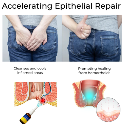 Cvreoz® Herbal Hemorrhoid Treatment Anal Spray