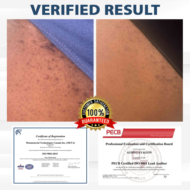 LicorRelief Man Genital Antifungal Cream