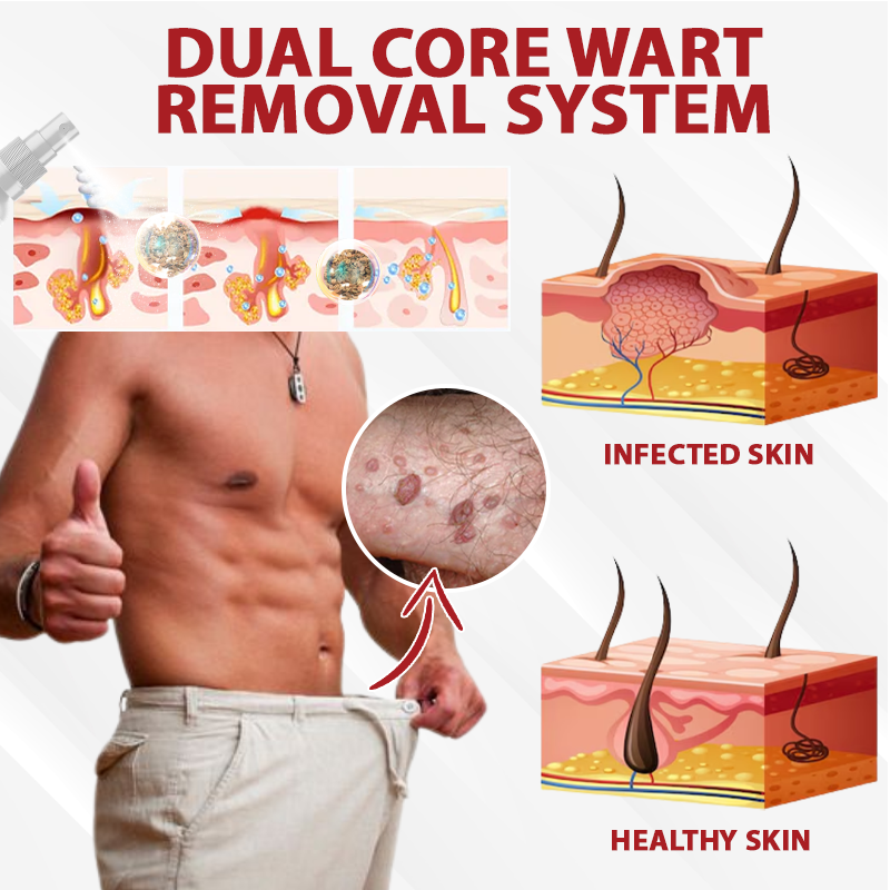 Men's HPV Warts Care Spray