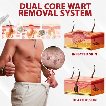 Men's HPV Warts Care Spray